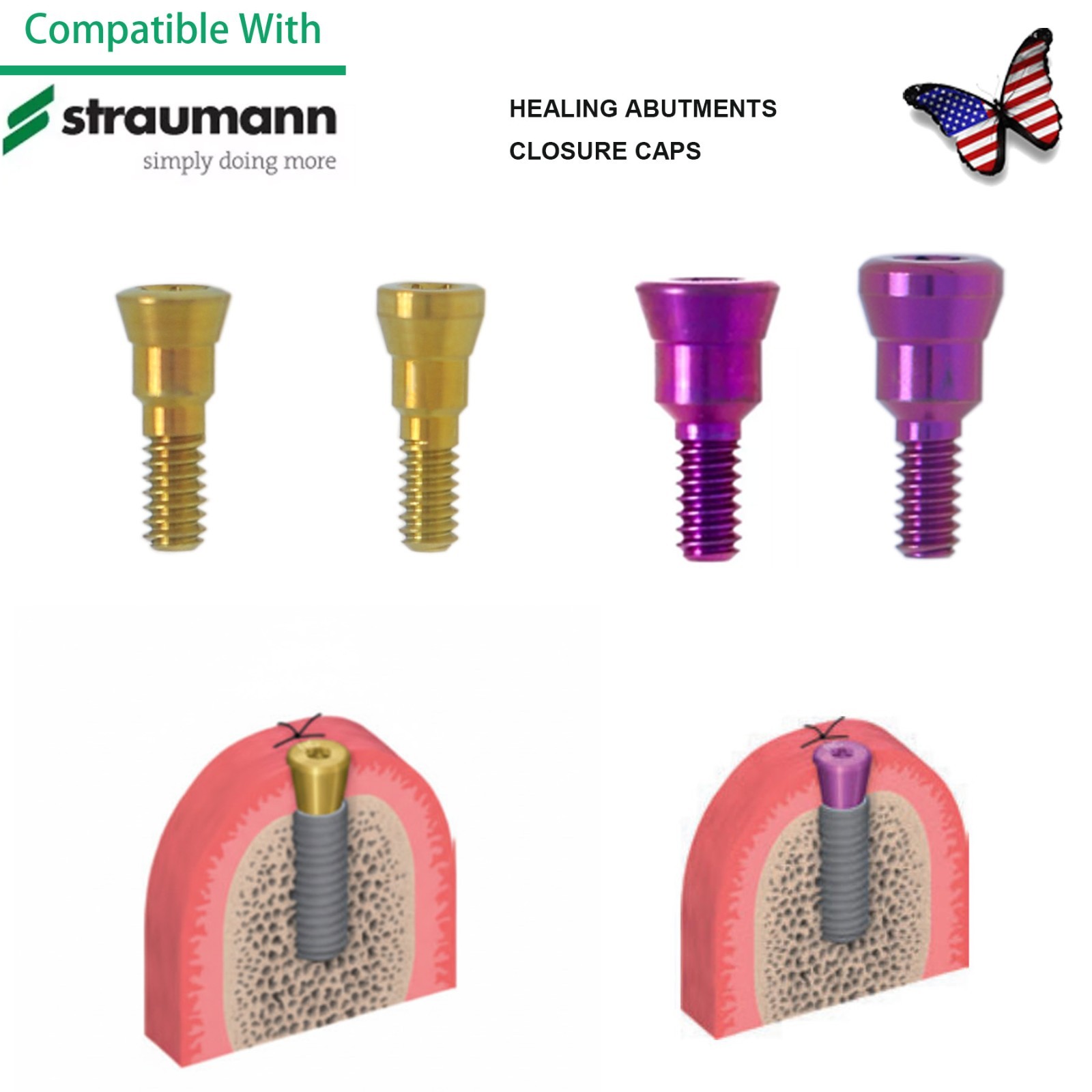 US Straumann Healing Abutment Cap/Closure Cover Screw NC & RC Platform Titanium