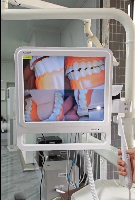 Dental Digital Intraoral Camera with Electric Monitor