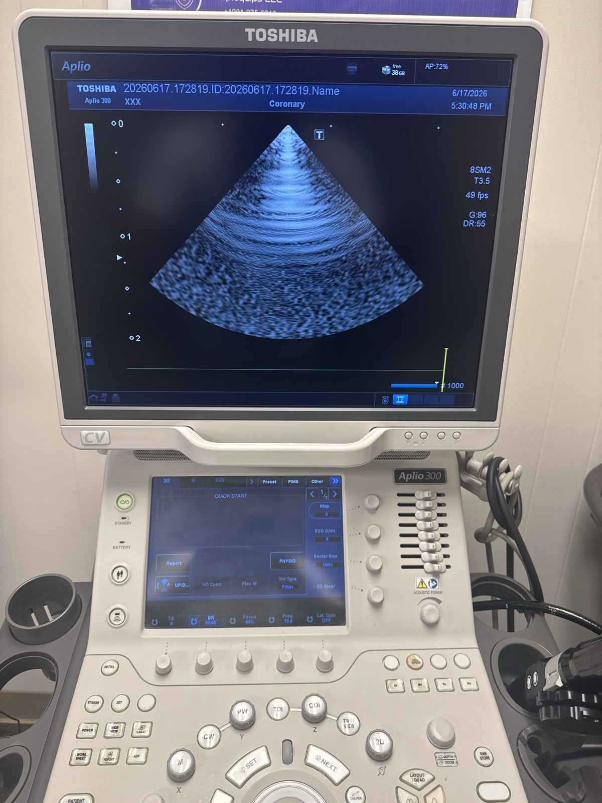 TOSHIBA APLIO 300CV Platinum Ultrasound 4 Probes PST-30BT PLT-704SBT PET-512MC