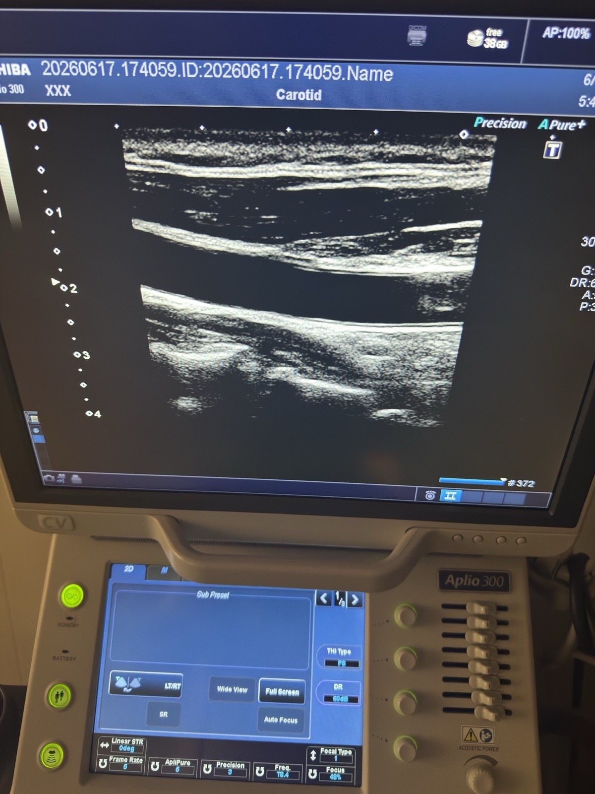 TOSHIBA APLIO 300CV Platinum Ultrasound 4 Probes PST-30BT PLT-704SBT PET-512MC