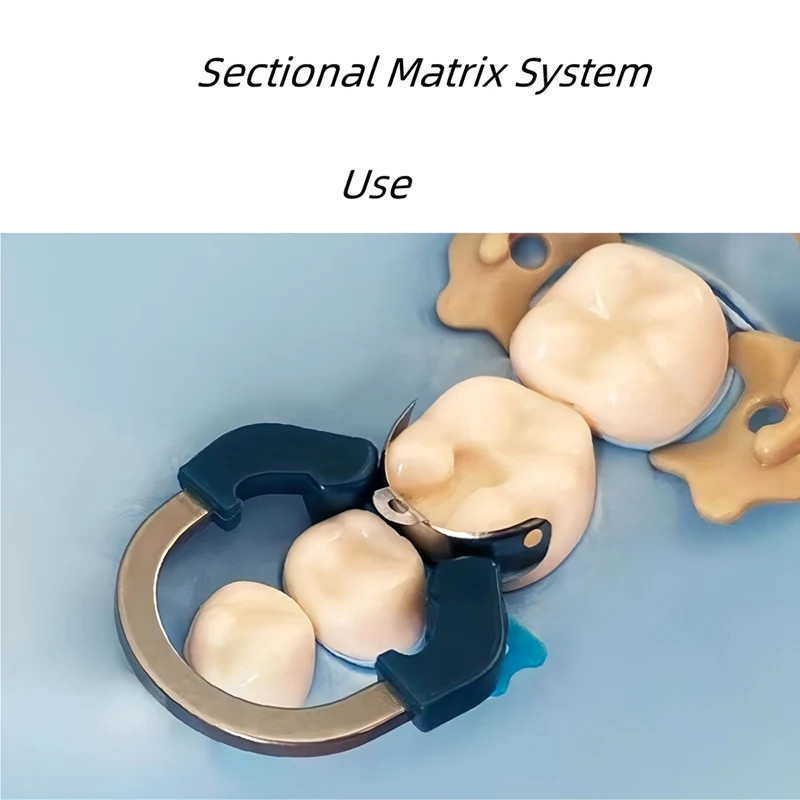 Dental Matrix Bands Clamp Ring Palodent V3 Sectional Matrix System Wedges Pliers