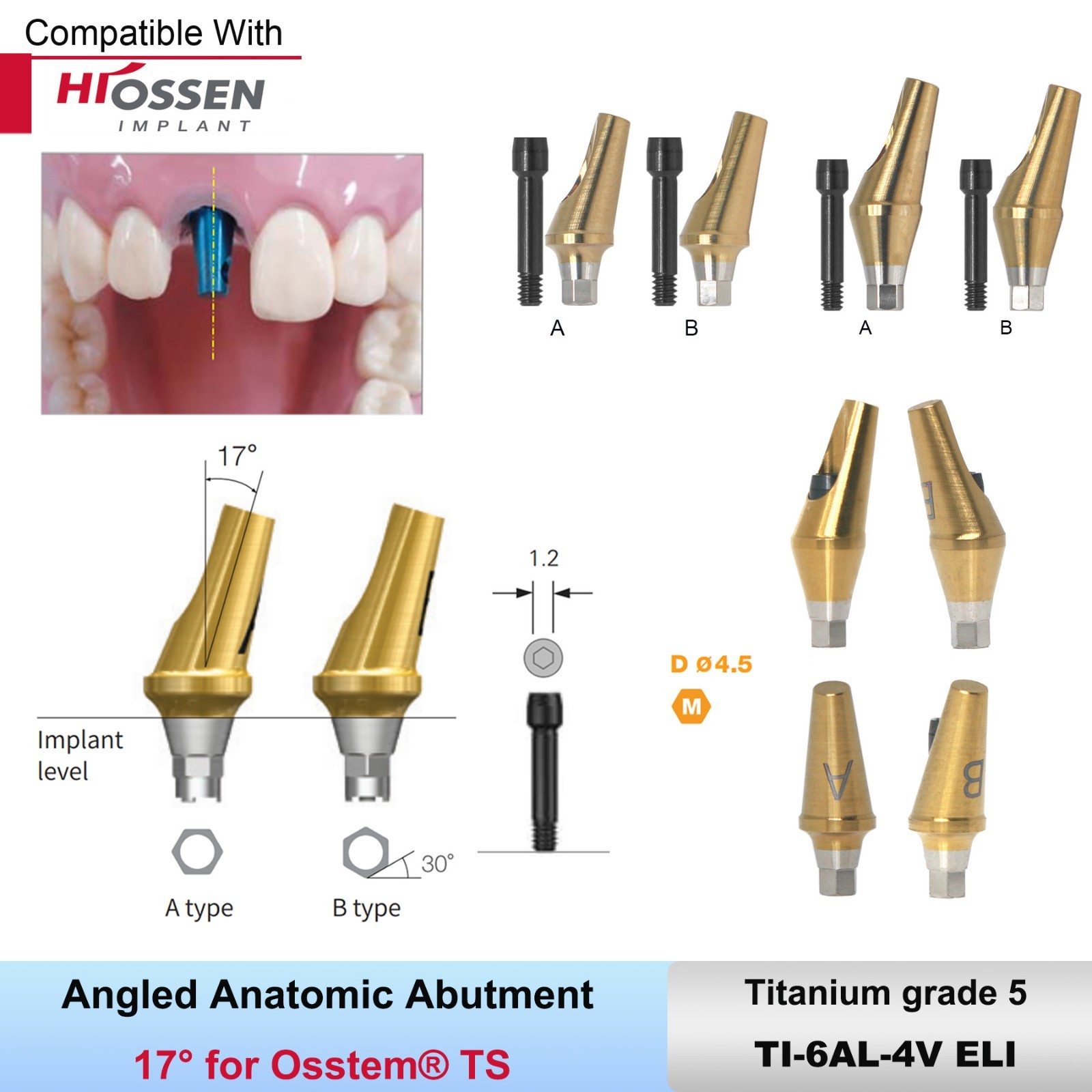 Titanium Straight & 17° Angled Transfer Abutment Compatible Osstem TS/Hiossen ET