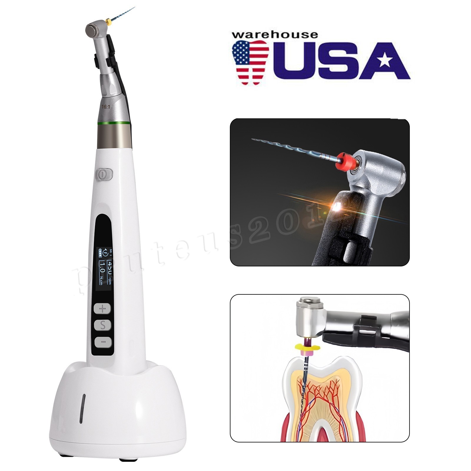 Dental LED Wireless Endo Motor 16:1 Reciprocating Root Canal/16:1 Head Handpiece