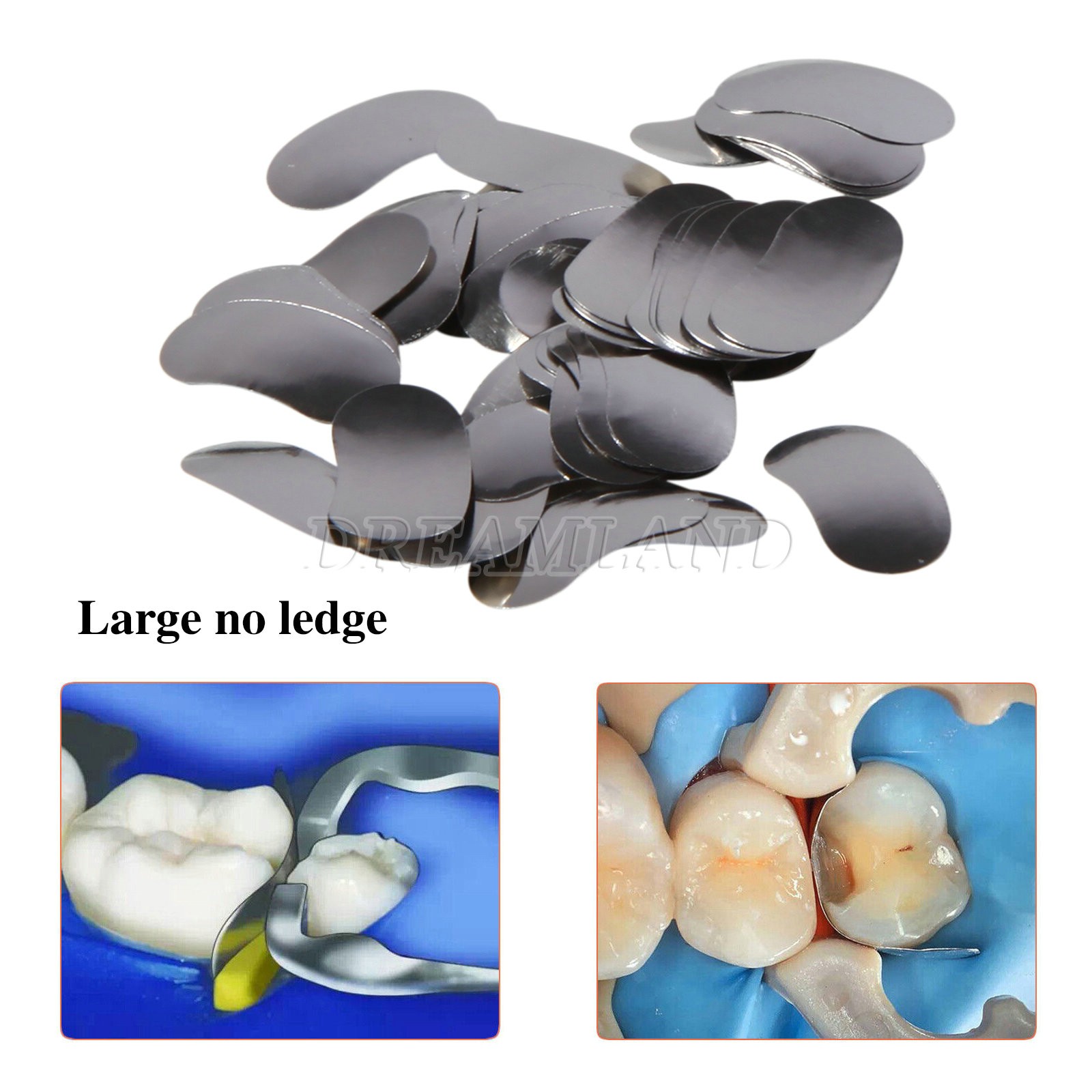 100 Pcs Dental Sectional Contoured Metal Matrices Refill Matrix Band Ledge 35um