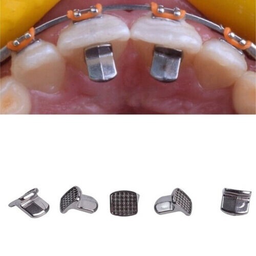 50Pcs Dental Orthodontic MIM Bite Turbos Tongue Tamers Monoblock Bondable Hinge