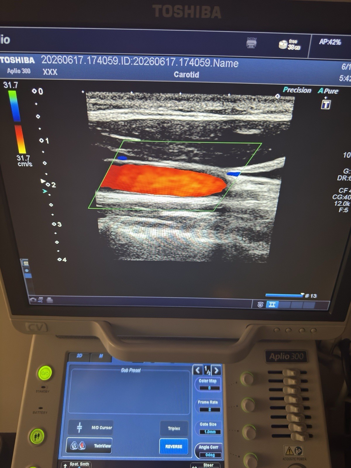 TOSHIBA APLIO 300CV Platinum Ultrasound 4 Probes PST-30BT PLT-704SBT PET-512MC