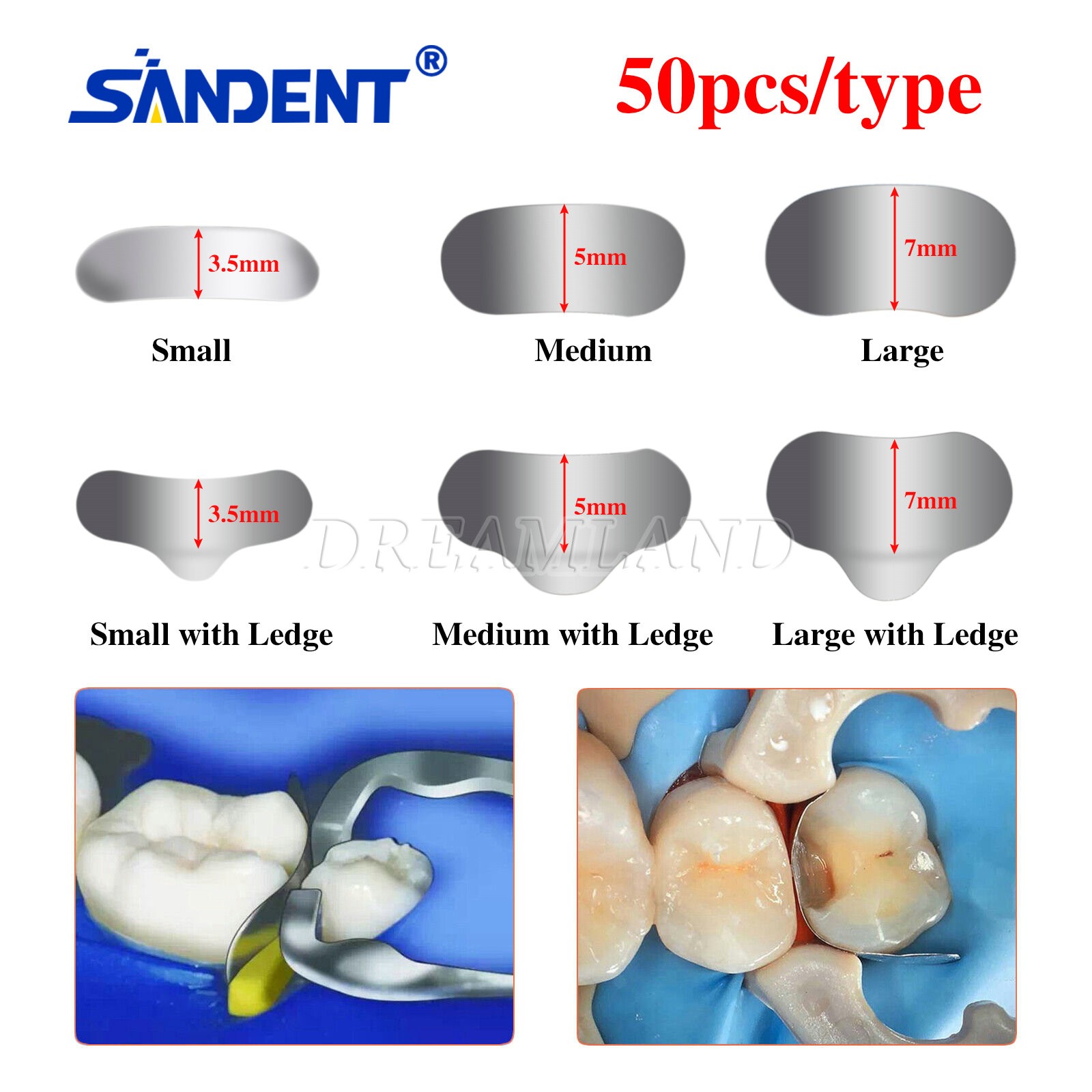100 Pcs Dental Sectional Contoured Metal Matrices Refill Matrix Band Ledge 35um
