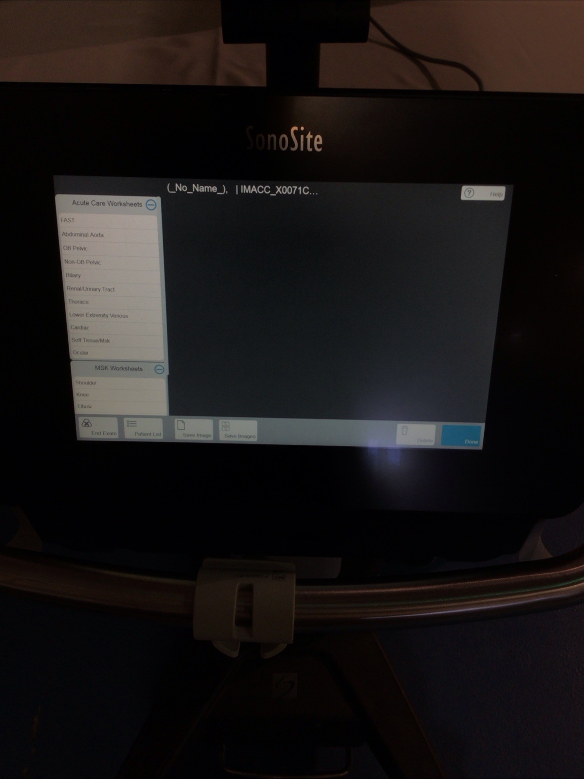 Sonosite X-Porte Ultrasound W Engine, Sony Printer, No Transducers