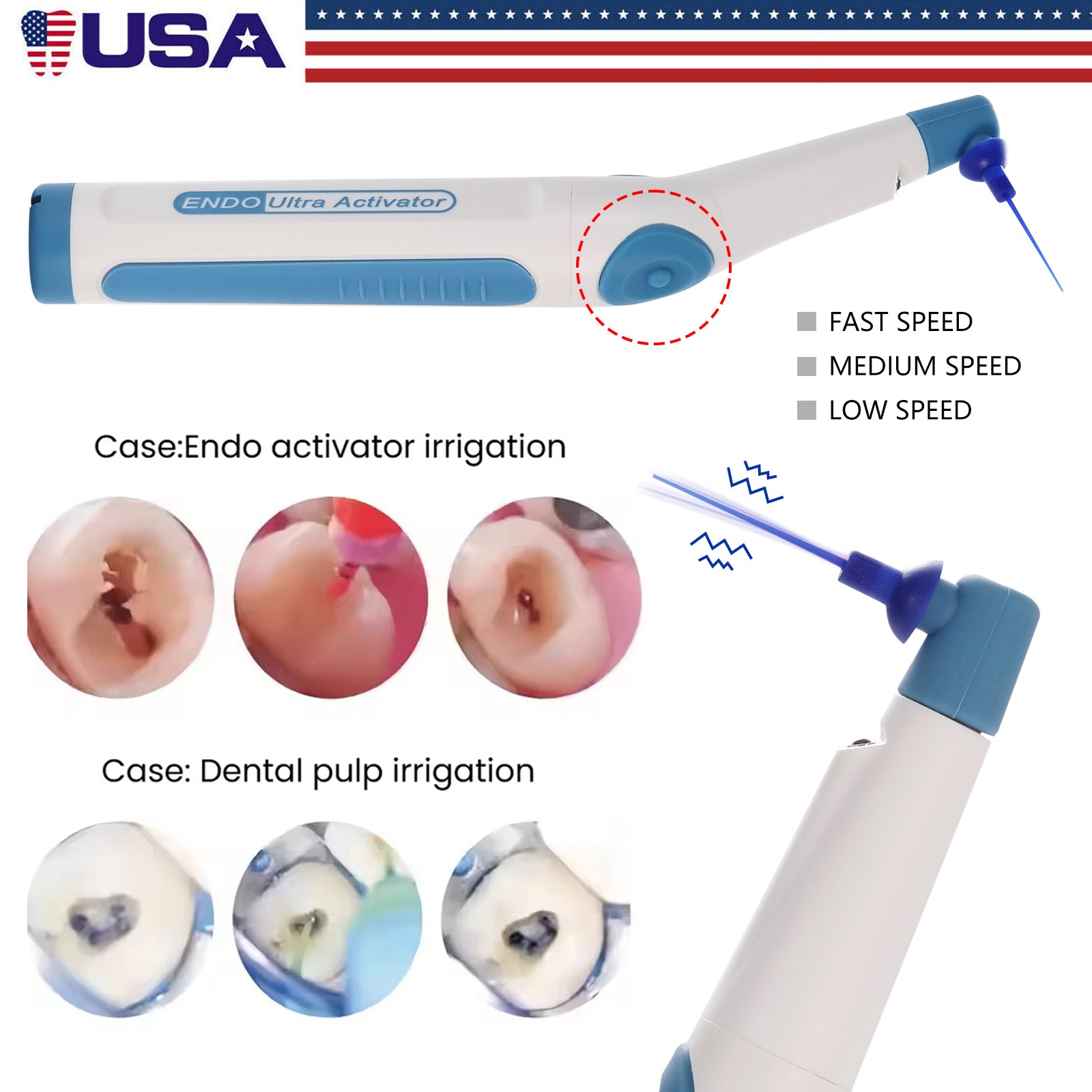 Electrosurgery Unit Dental Electro Dentisty System – High Frequency ES-20 USA
