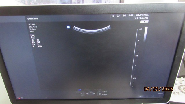 Samsung HS50 w/ 2 Probes: CA2-9AD and EVN4-9