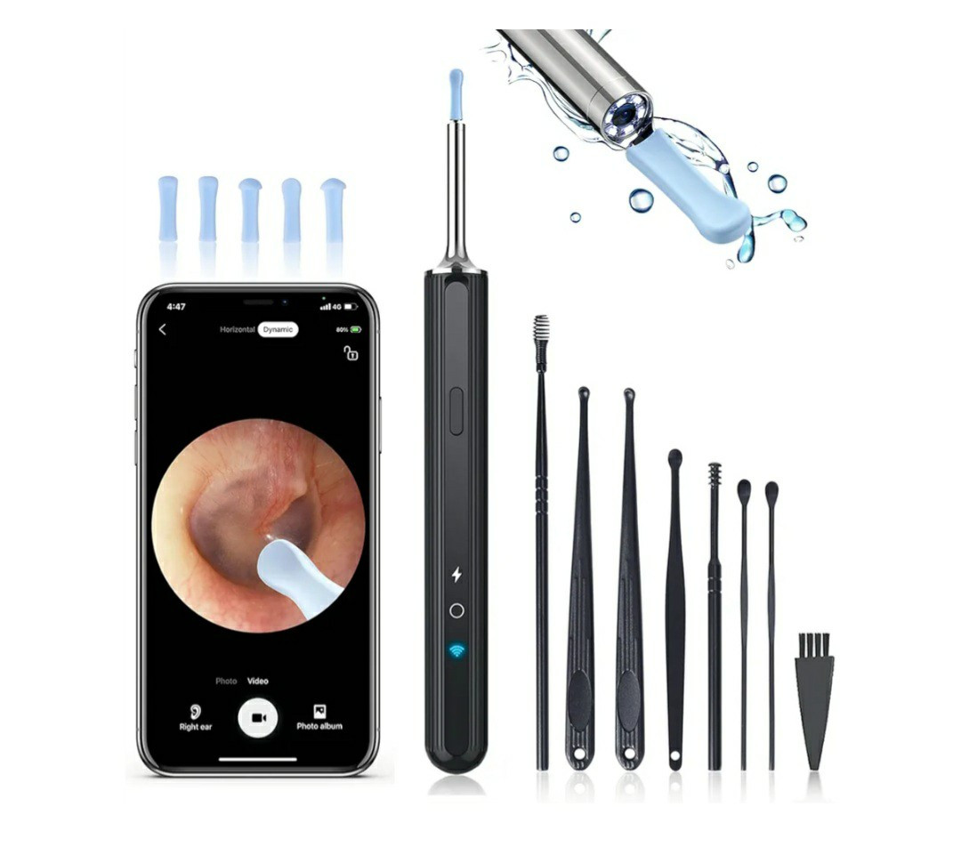 Wireless Ear Wax Removal Camera – Ear Wax Removal Tool Camera – Ear Wax Removal