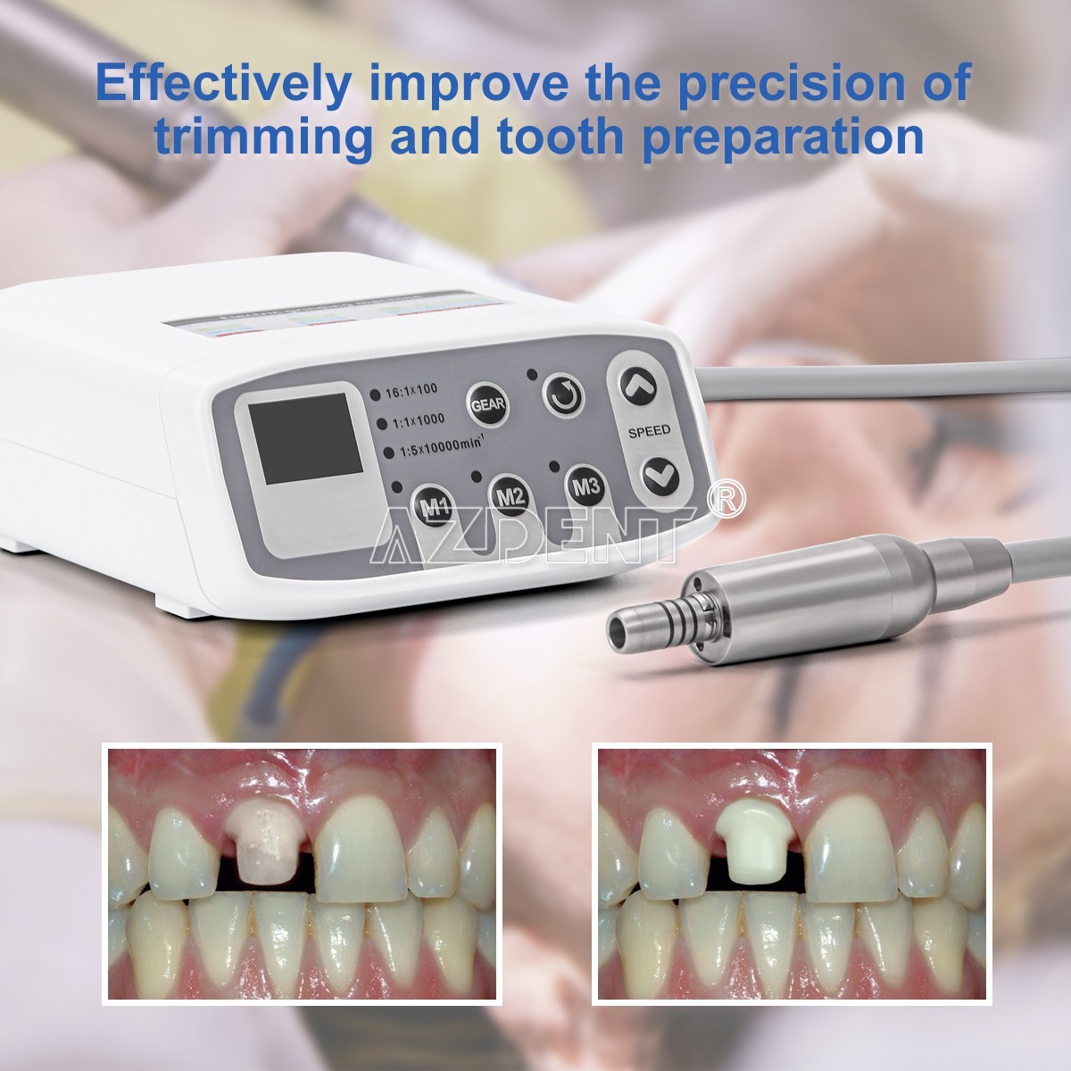 AZDENT Dental Electric LED Brushless Micro Motor Fit For E-type Handpieces