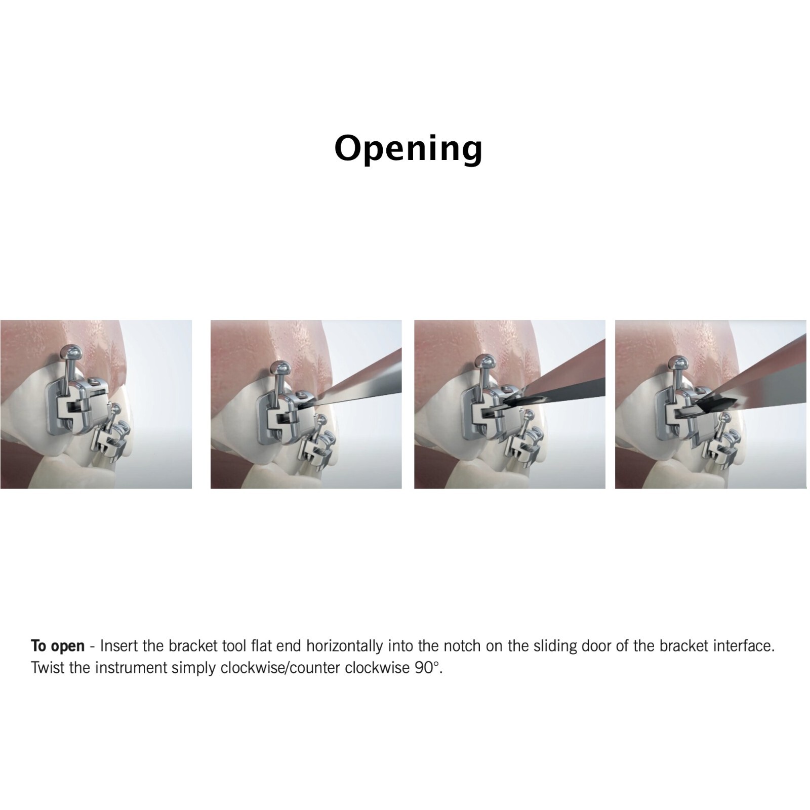 Dental Orthodontic Self Ligating Brackets Buccal Tubes Metal Roth 022 DAMON Q