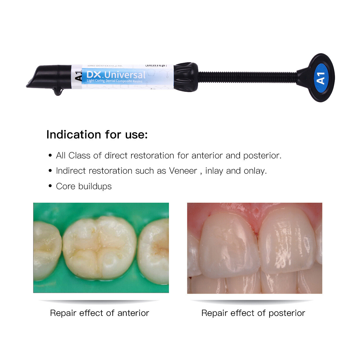 Dentex Dental Curing Light Type Composite Resin Shade A1 A2 A3 A3.5 B1