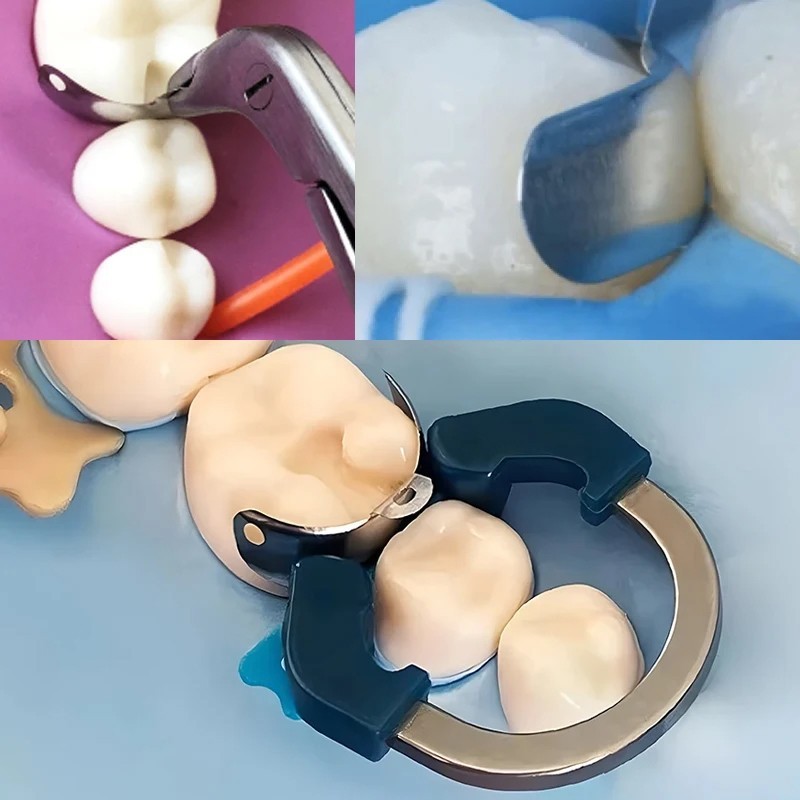 Dental Matrix Bands Ring Sectional Matrix System Tulwar Wedges Fit Palodent V3